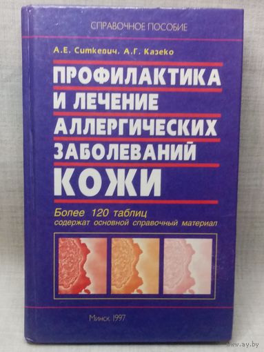Профилактика и лечение аллергических заболеваний кожи. А.Е. Ситкевич, А.Г. Казеко 1997 г