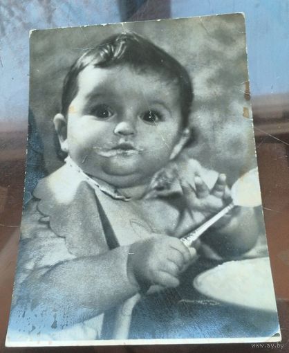 1965 год Ожирение у детей